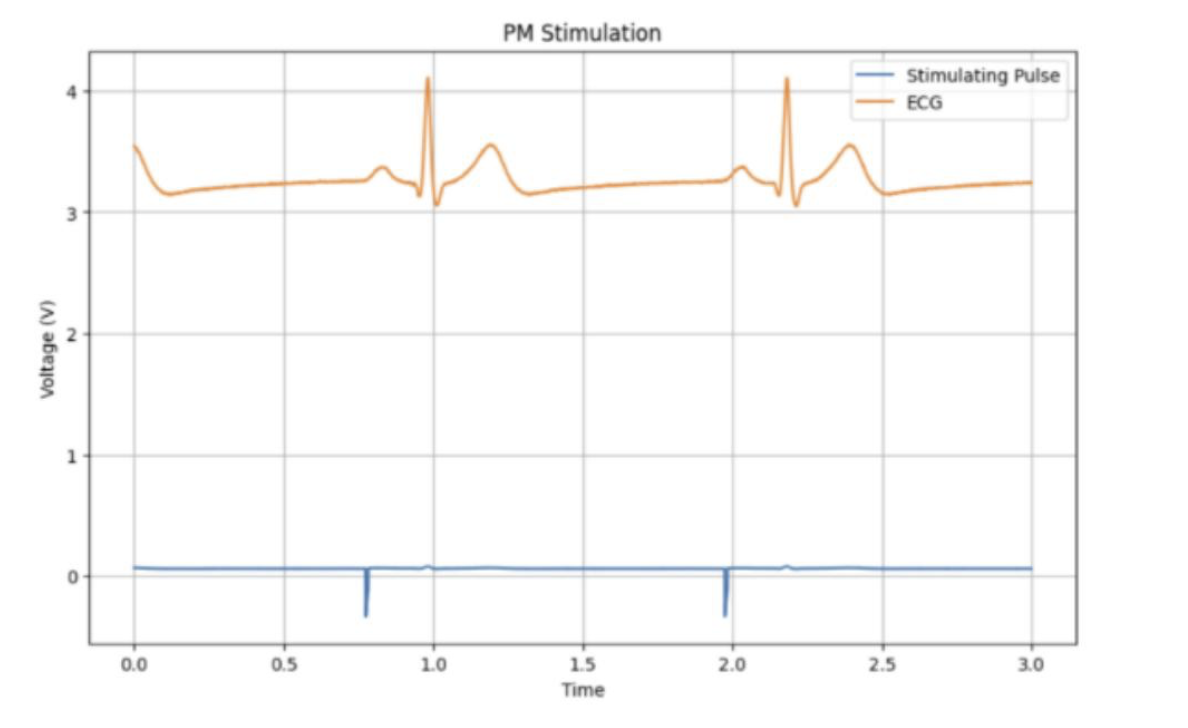 Pacemaker firing to set correct least time interval